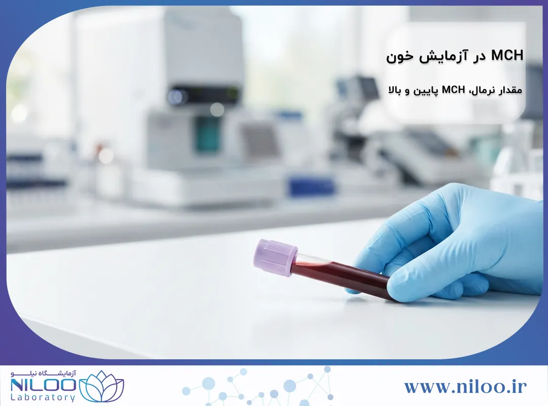 MCH در آزمایش خون چیست؟ مقدار نرمال، MCH پایین و بالا