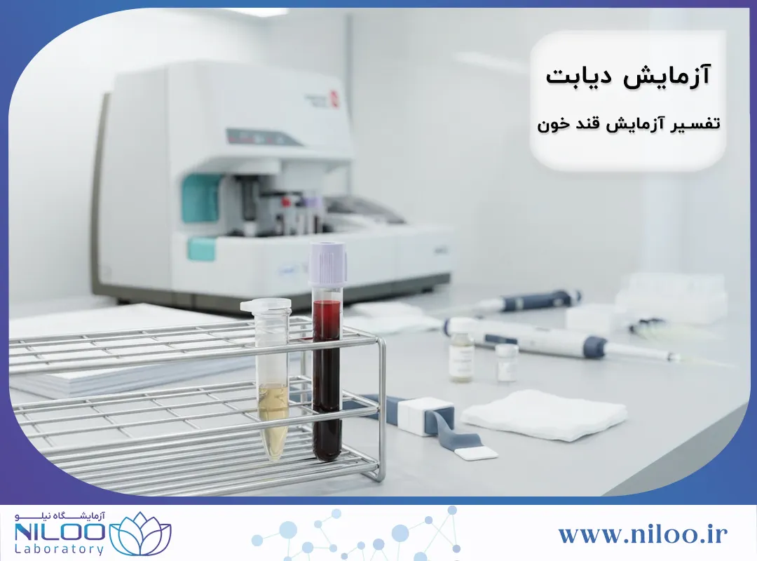 آزمایش دیابت چیست؟ تفسیر FBS، HbA1c و قند خون