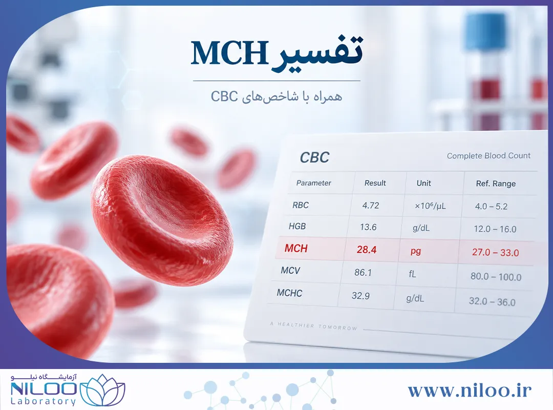 تفسیر آزمایش mch